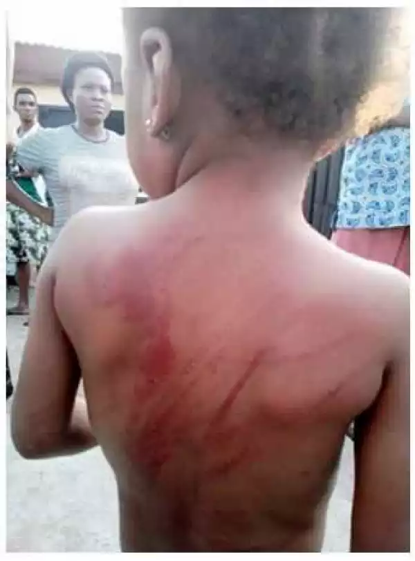 Photos: Cruel Father Brutalises 4-Year-Old Daughter For Misplacing Slippers